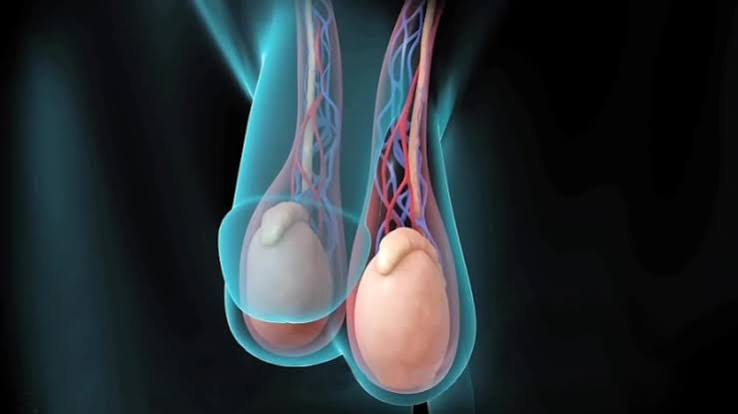 Cirurgia de varicocele - Dr. Rodrigo Bomfim